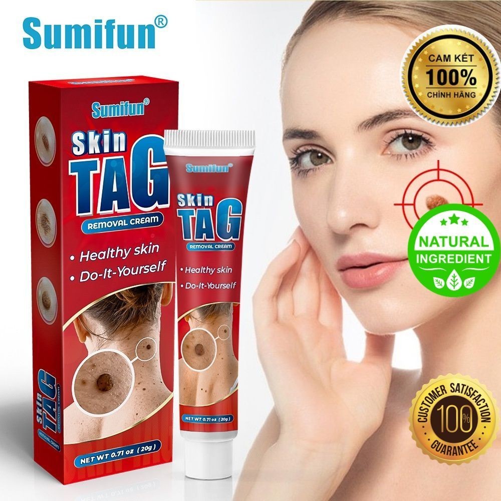 Wart cream wart remover ointment mole cream tag remover 5g face mole