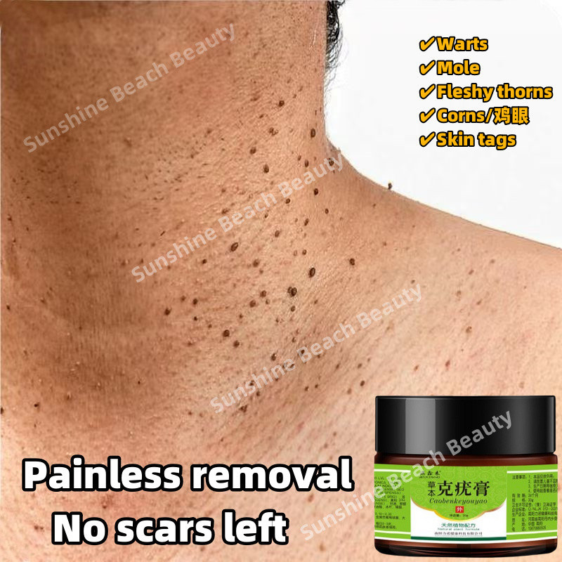 Remove Warts/mole/fleshy thorns/corns medicine wart remover warts ...