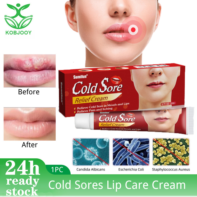 20g Cold Sores Lip Care Cream Repair Cheilitis Lips Herpes Ulceration ...