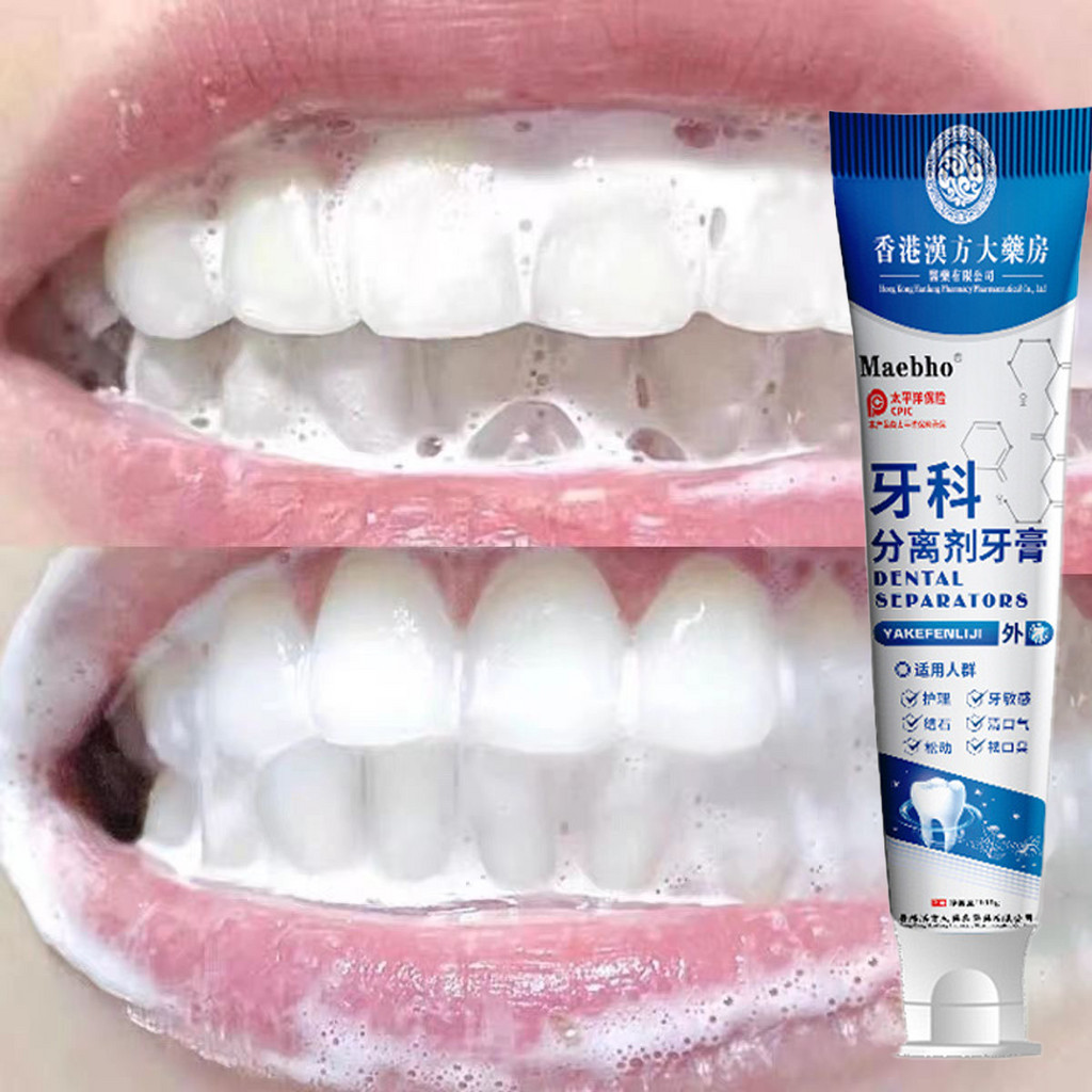 [Tik Tok Preferred] [Quick Whitening Teeth] Whitening Stain Removal