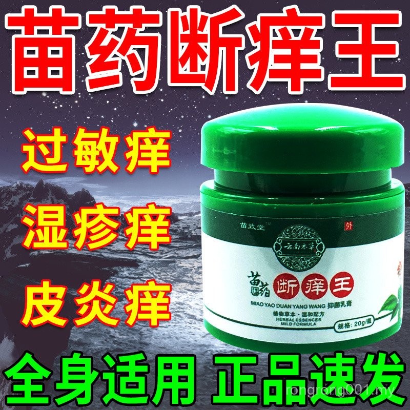 New Product Itchy Skin Anti-Itch Cream Skin Allergies Body Itchy ...