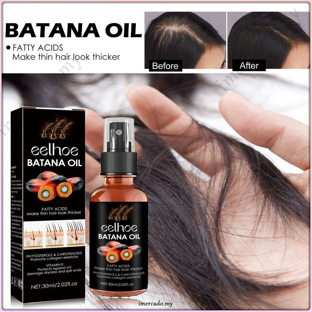 COD Eelhoe Batana Oil Hair Growth Spray Repair Baldness Hereditary Hair ...