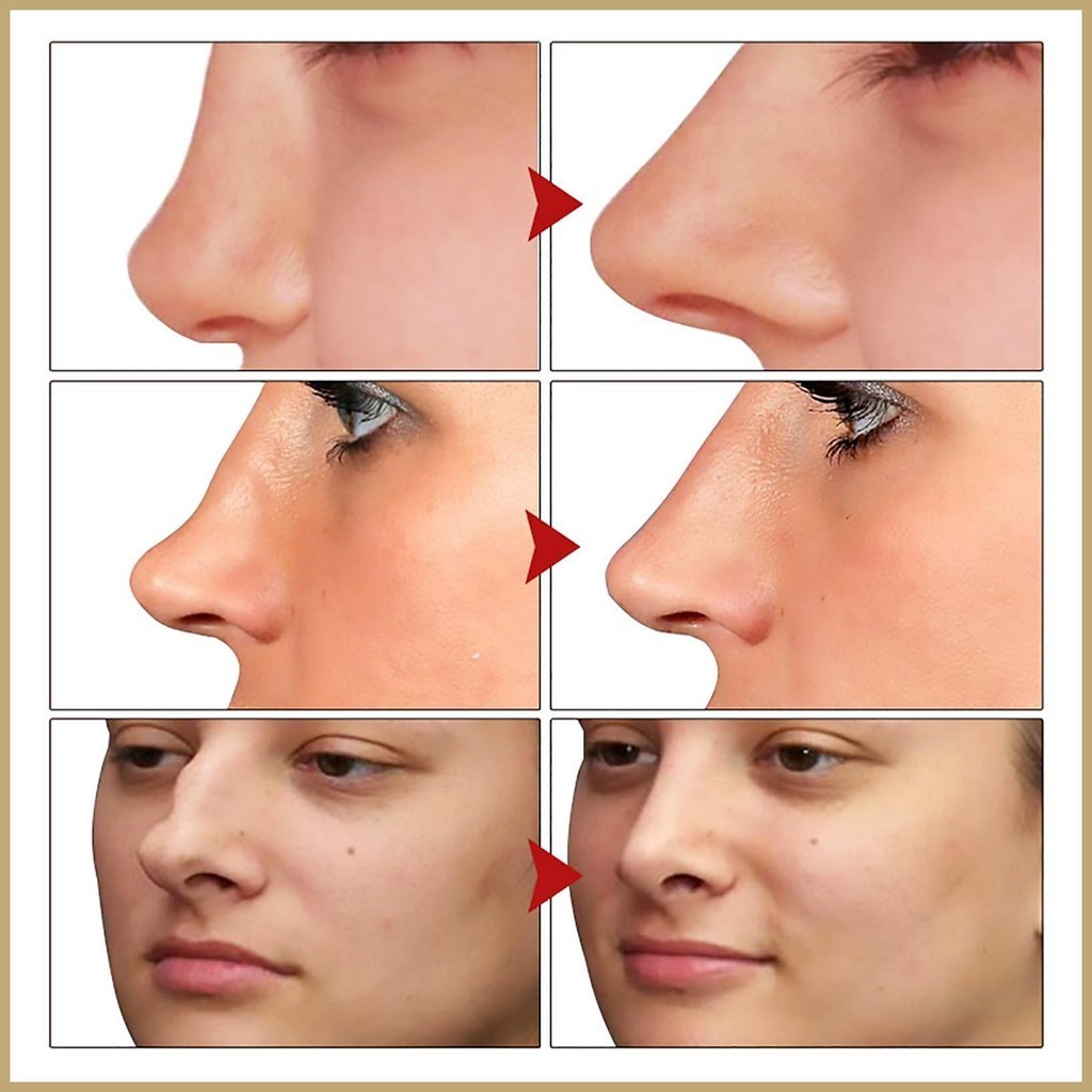 Nose Lift Shaping Oil Natural Shaping Drops for High Nose Lifting Oils ...