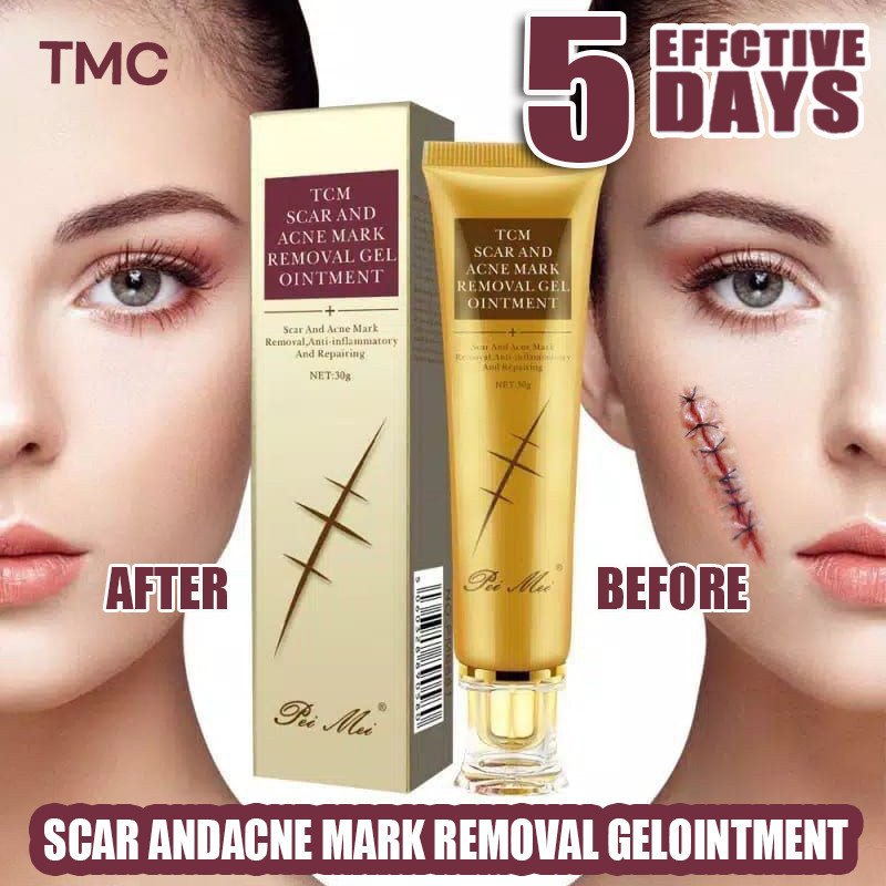 Tcm Scar Andacne Mark Removal Gelointment 30g Acne Scar Removal Gel