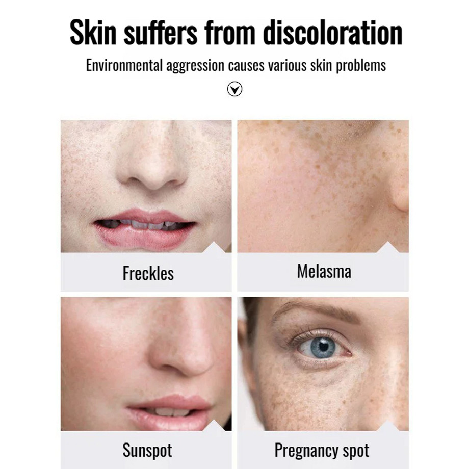 Melatonin Whitening Essence Brightening Spot Correcting Serum Good ...