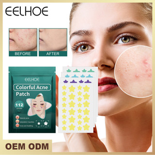 Pimple Patch - Acne Treatment Removal - Breathable, Invisible 