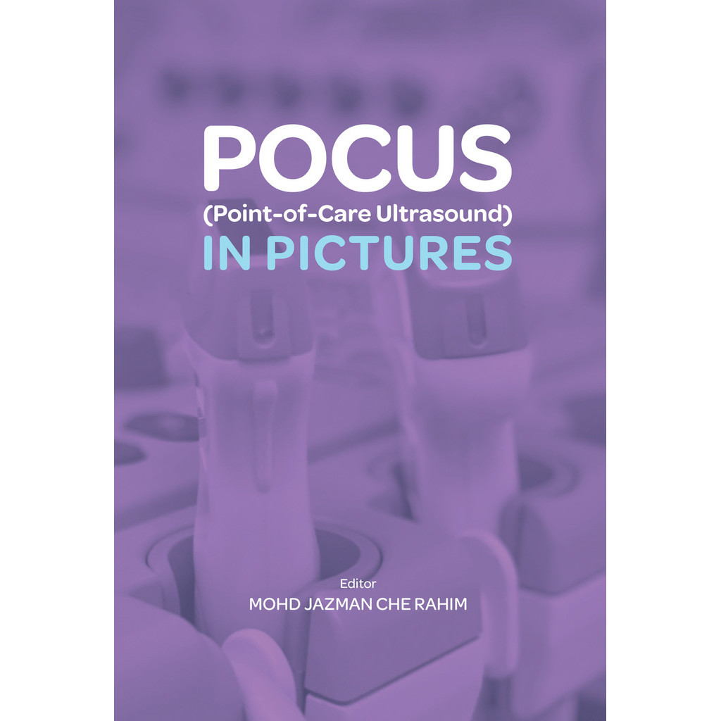 POCUS (Point-of-Care Ultrasound) In Pictures | Shopee Malaysia