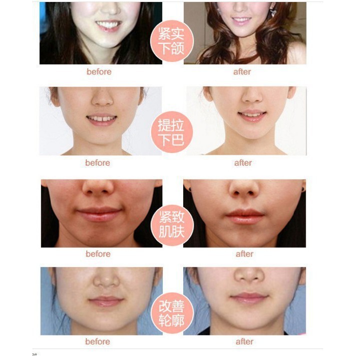 (SUPER EFFECTIVE) V Shape Face Mask V Shape Chin Restructure Sexy Face ...