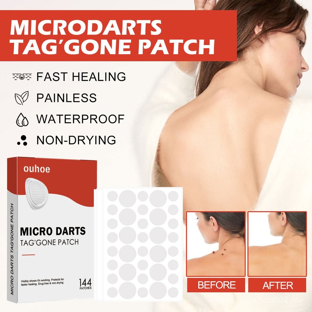 Ouhoe Acne Patch Skin Cleansing Acne Acne Black Mole Gram Wart Corn ...