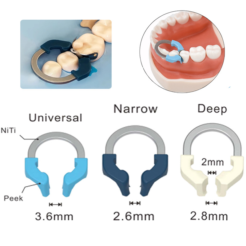 Dental Sectional Matrix System Sectional Contoured Matrix Bands Nickel ...