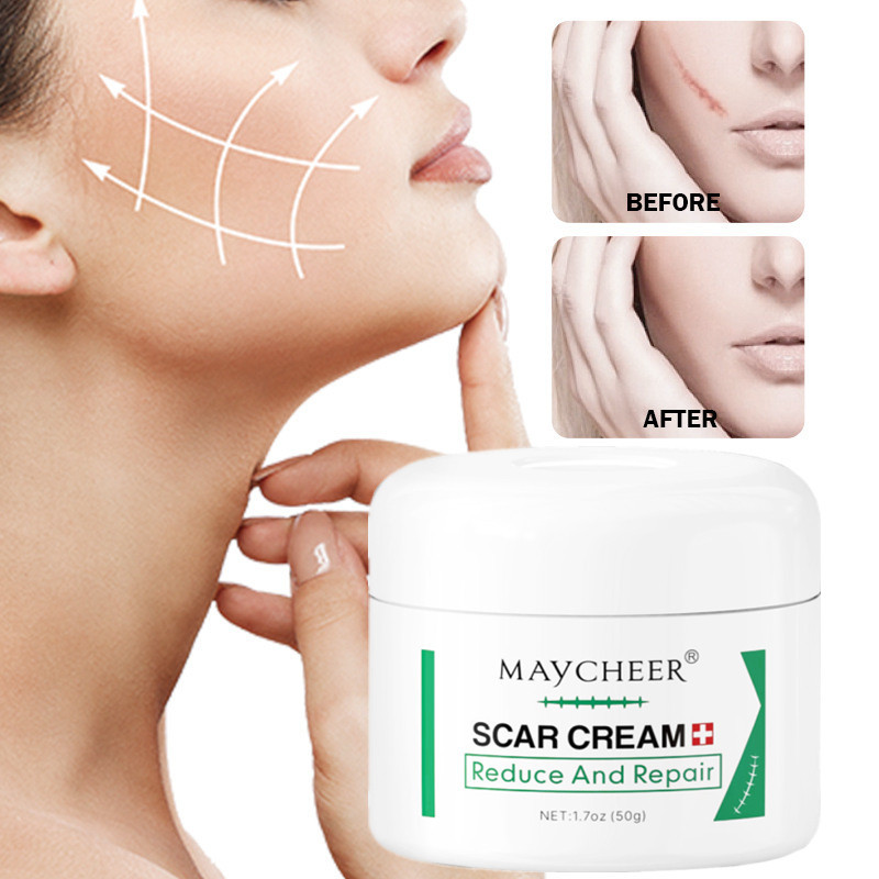 MAYCHEER Scar Repair Cream 50g Fade Scar Marks Stretch Marks Inhibit ...