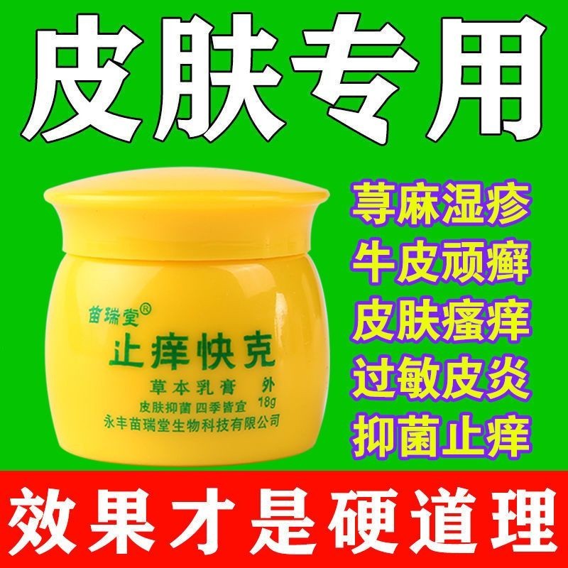 ((ready Stock) Anti-itch Crack (18g) Cracky Chronicle Nettle Rash Cream ...