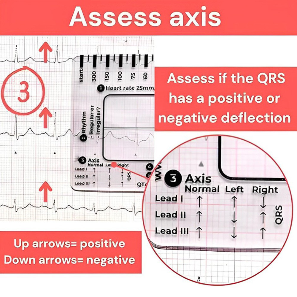 [Seriena.my] ECG 7 Step Ruler Portable ECG Measuring Card Reference ...