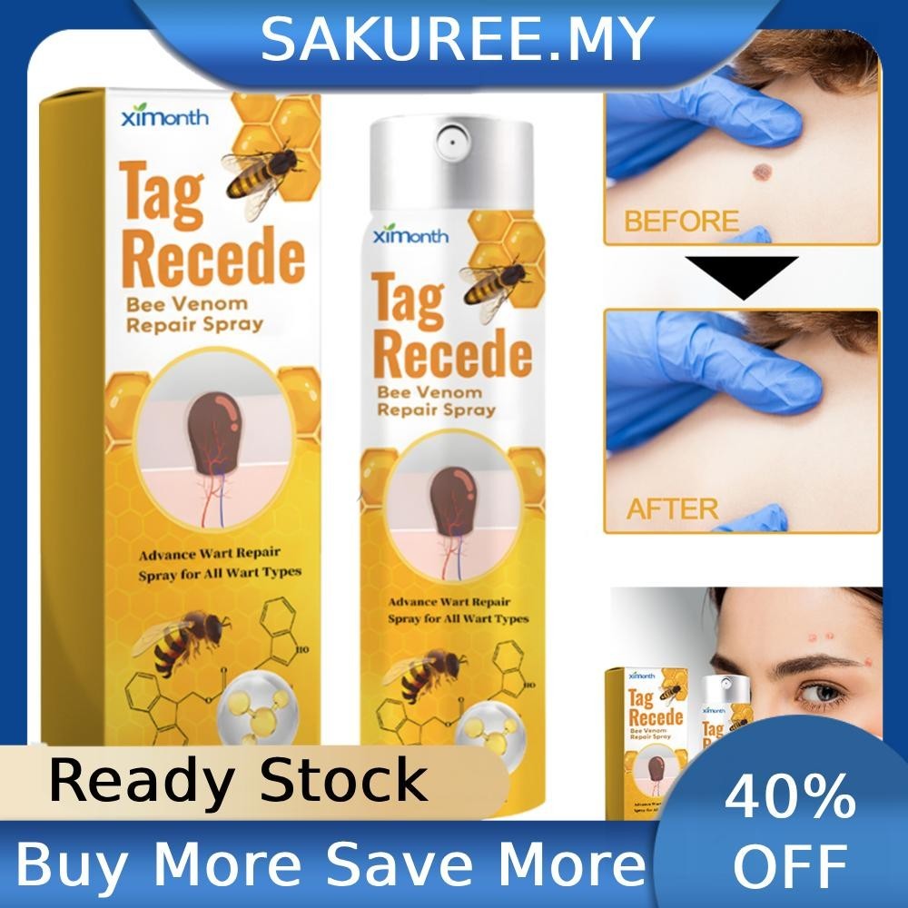 20ml Bee Venom Spray Tag Recede Bee Venom Spray Bee Venom Treatments ...