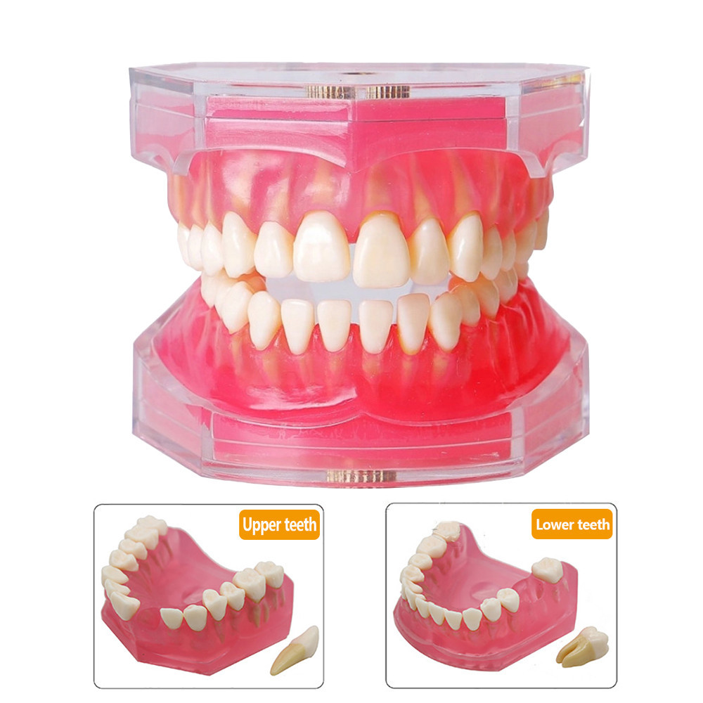 Dental Model With Removable Tooth Jaw Soft Gum Dental Teaching Studying ...