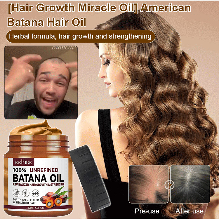 🌟[Hair Miracle oil] American Batana hair oil,Batana Oil for Hair Growth ...