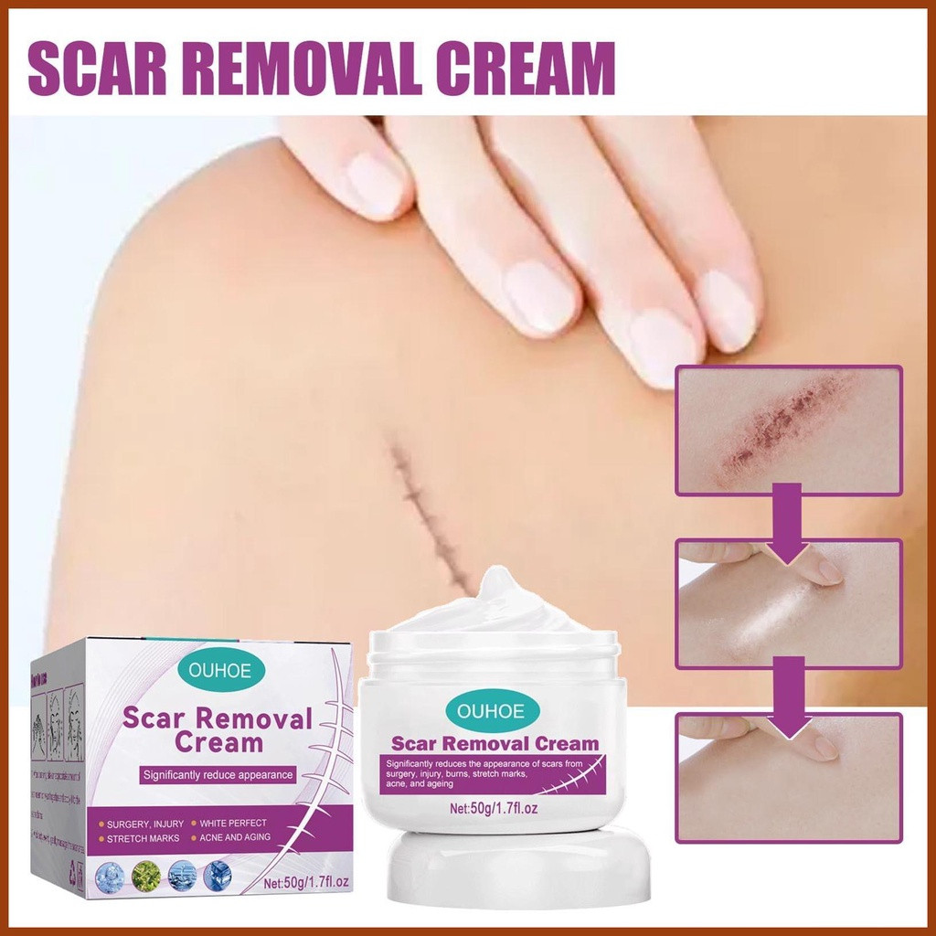 Scar Removal Cream Repair Scars Operation Scald Cream 50g | Shopee Malaysia