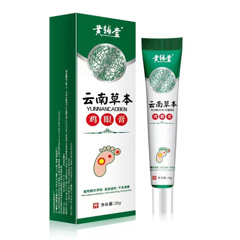 Genuine Corn Cream Cocoon Cream Toes Foot Hand Root Chicken Eugenic ...