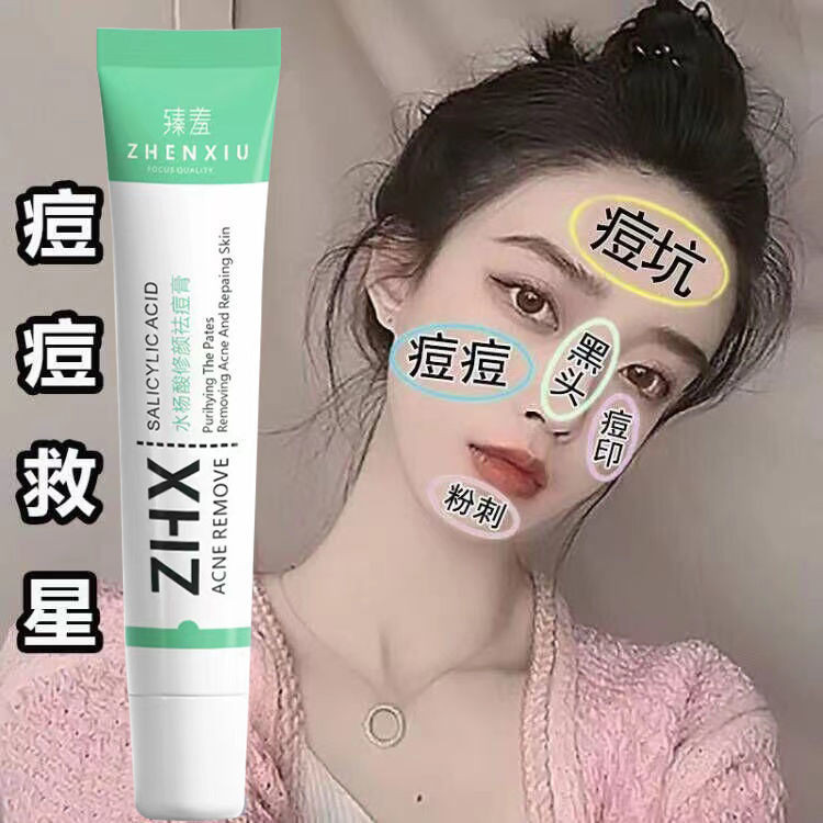 祛痘霜/祛痘膏 Acne cream/cream 水杨酸 祛痘膏 淡化痘印 去闭口粉刺 痘疤 痘坑 改善黑头 青春痘 男女 通用 4.18 ...
