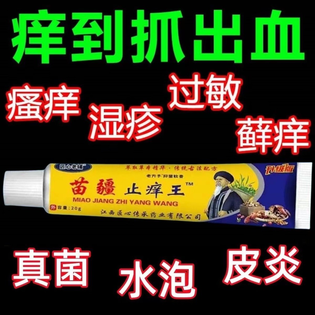 Skin Itching King] Miaojiang Itching Cream Powerful Skin Itching Skin ...