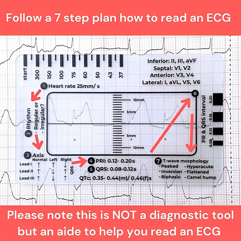 1/2Pcs ECG 7 Step Ruler ECG Ruler ECG Reference Guide for ECG/EKG ...