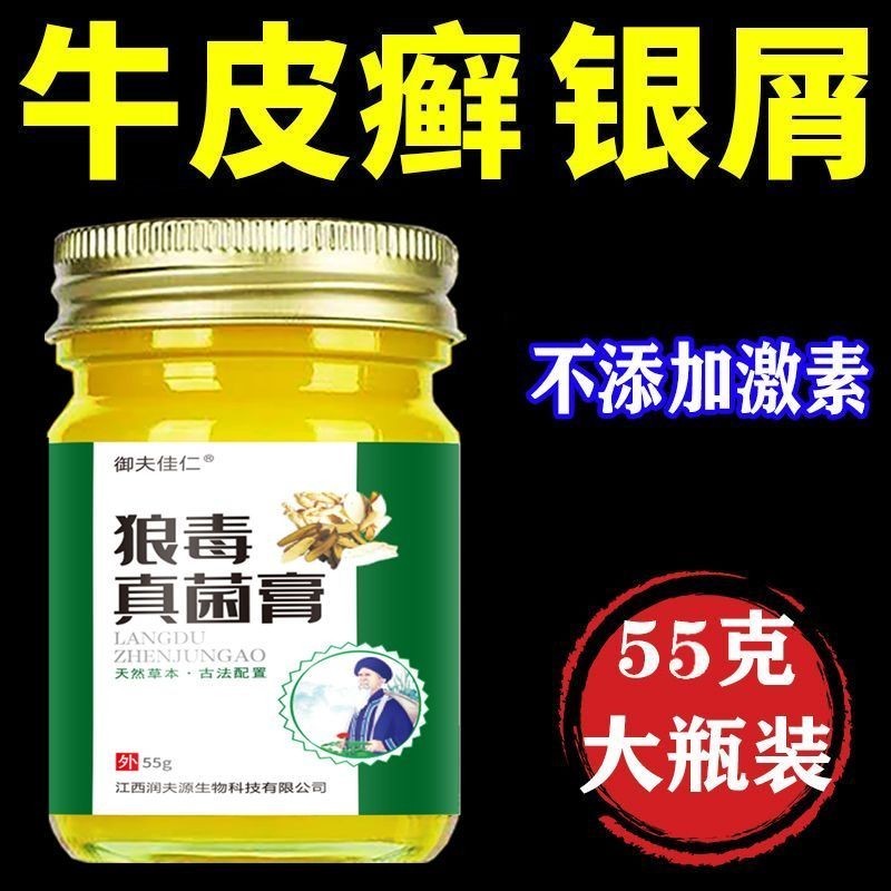 Cowhide Dedicated Ointment Silver Dandruff Disease Dedicated Effect ...