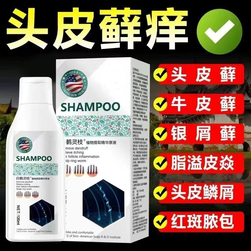 Special shampoo for dandruff, scalp ringworm, scalp itching, dandruff