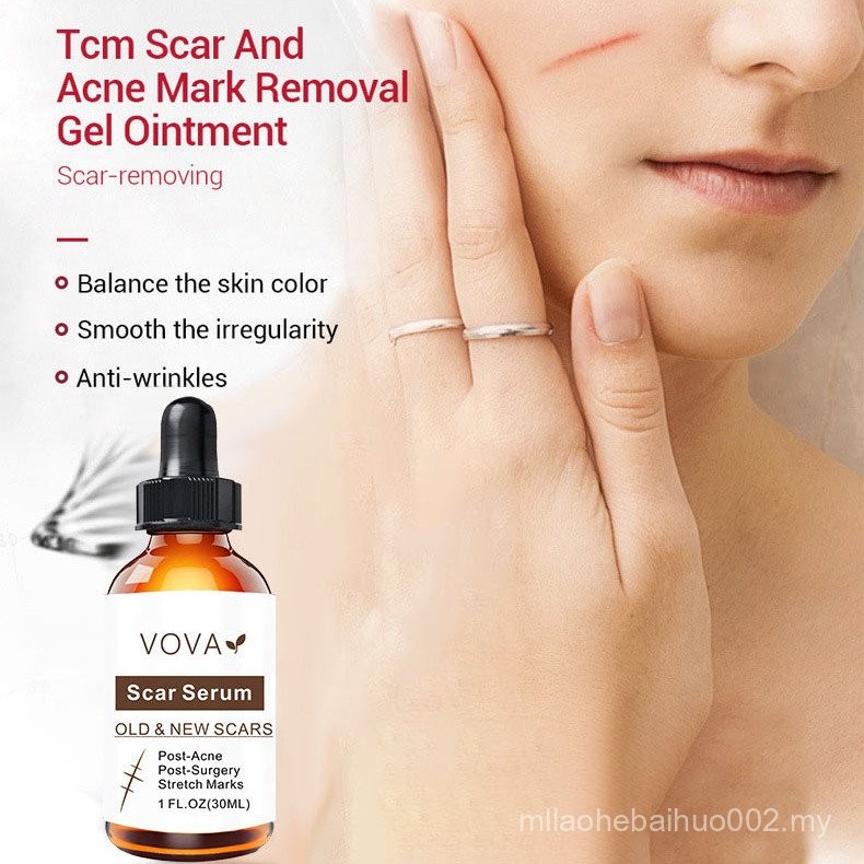 Kulit Tangan Terurus Dalam Aktiviti Harian