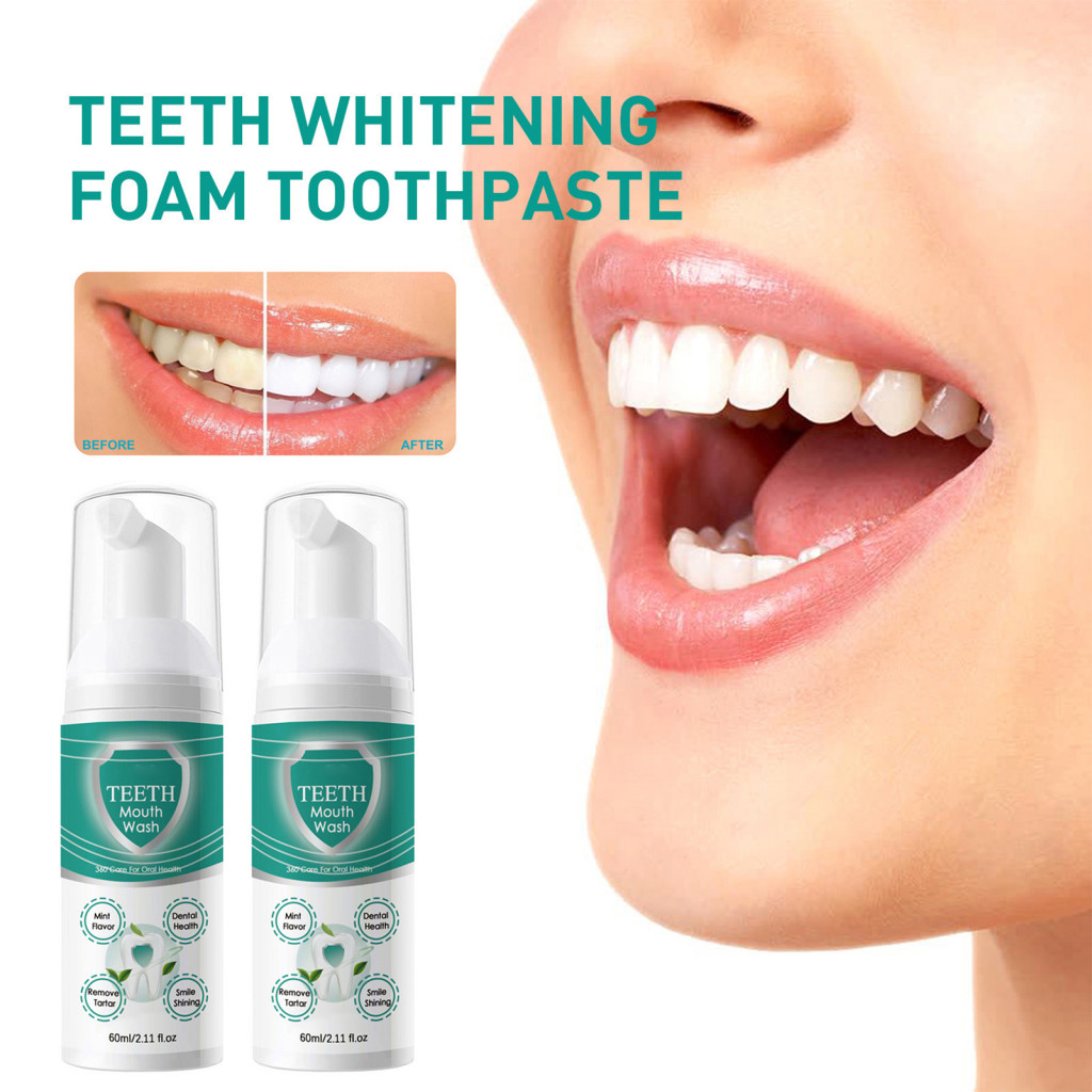 Breath Eliminating Mouthwash Tonsil Stones Mouthwash Freshen Your Breath with 60ml Teeth