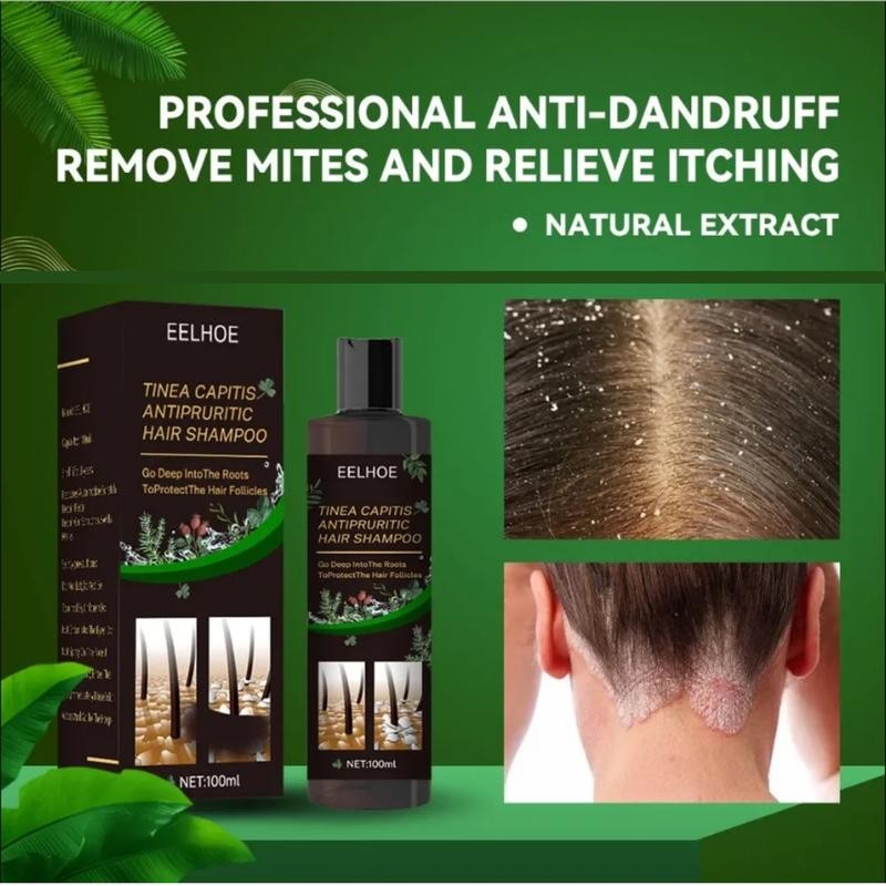 Relieve Itchy Scalp Anti Dandruff Shampoo Reduce Dandruff Control Oil ...