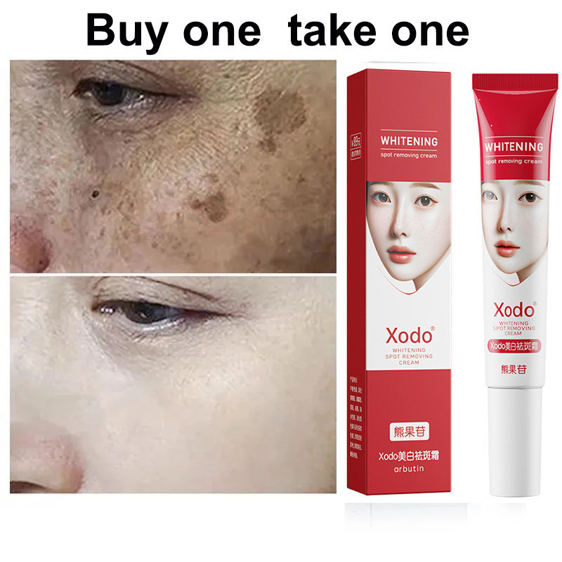 SuperWhite Skin Whitening Cream – 20g, Dark Spot Remover For Face, Neck & Body, All Natural