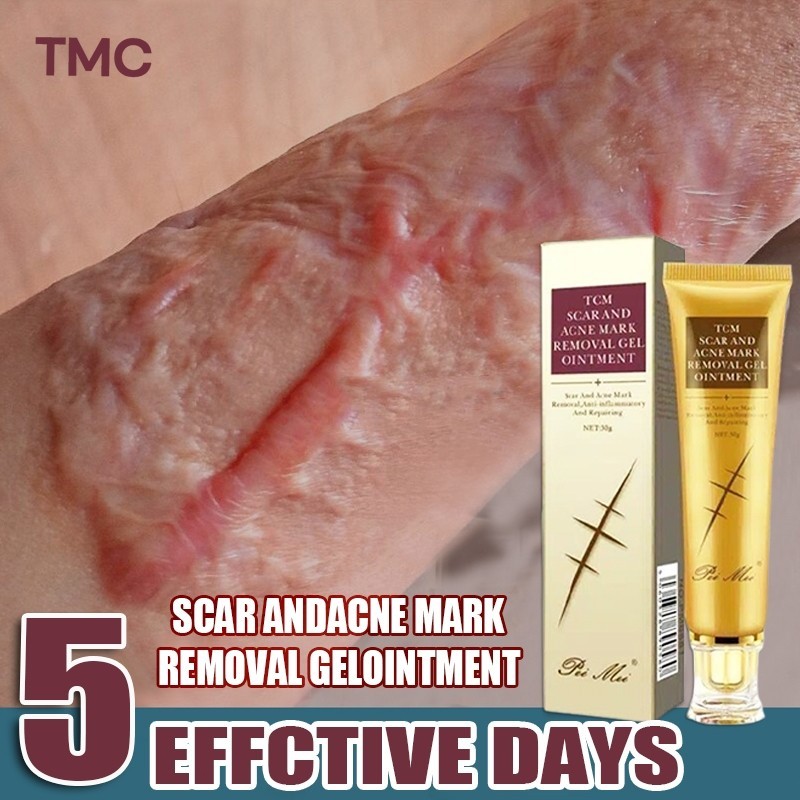HITAM Tcm Scar Removal Cream On The Face Scar Andacne Mark Removal