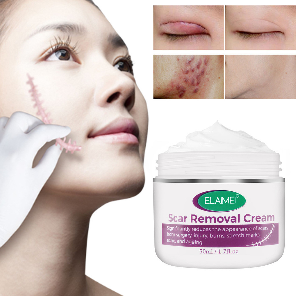 De-darkening Cream, Old Scar Removal, Leg Scars, Insect Bite Scars ...