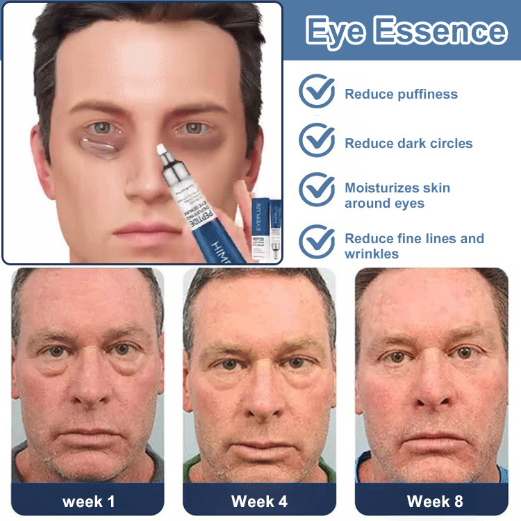 Eye Serum for Firmed Refined Hydrated and Lighter Dark Circles | Shopee ...