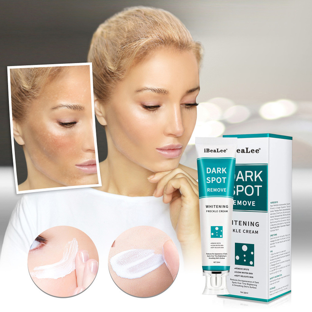 ReadyStockDark Stripe Remover Brightening & Lightening Pimple Marks