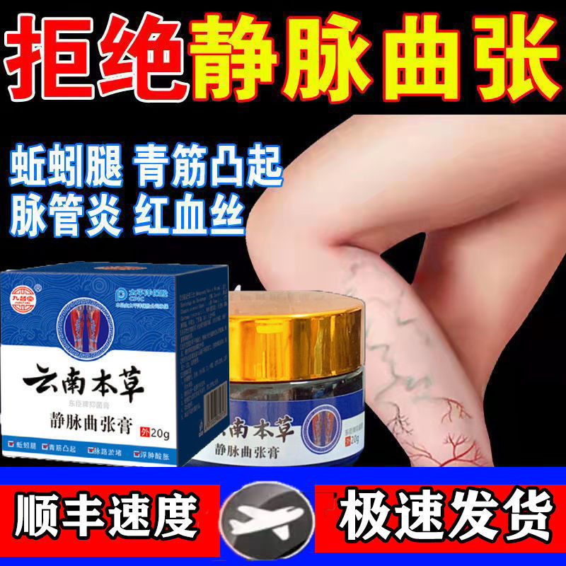 Official varicose vein cream, red blood threads, earthworm l Official ...