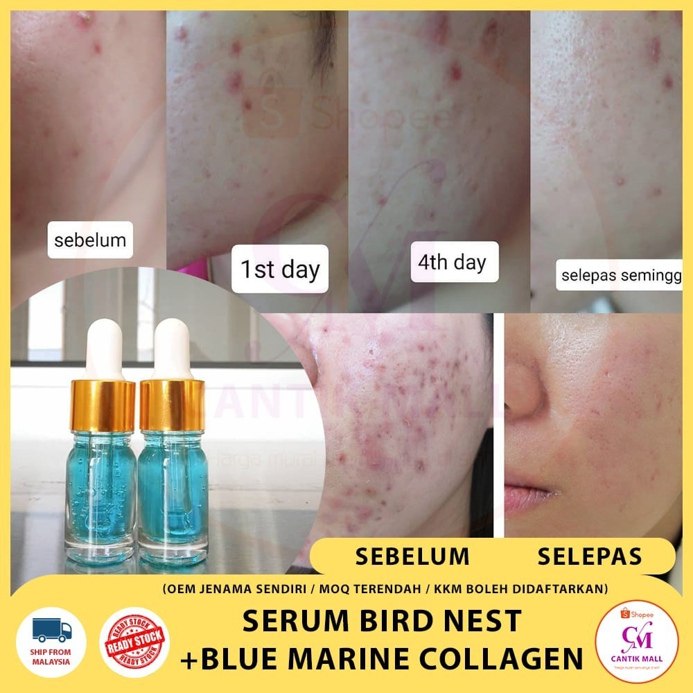 SERUM BIRD NEST + BLUE MARINE COLLAGEN Jenama Sendiri Ready Stock