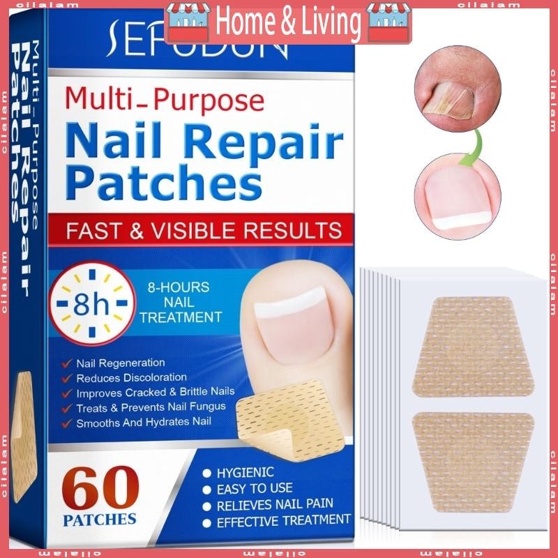 ci Ingrown Toenail Sticker Corrector Patches Big Toe Nail Corrector ...