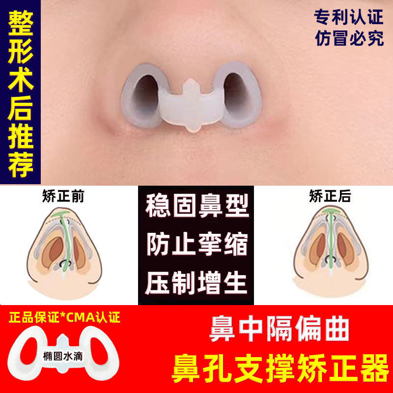 Styling nose support after comprehensive rhinoplasty, nostril dilator ...