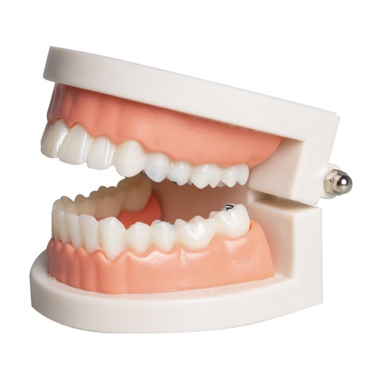Public Normal / Decay Tooth Model Aesthetic Practice Small Tooth Model ...