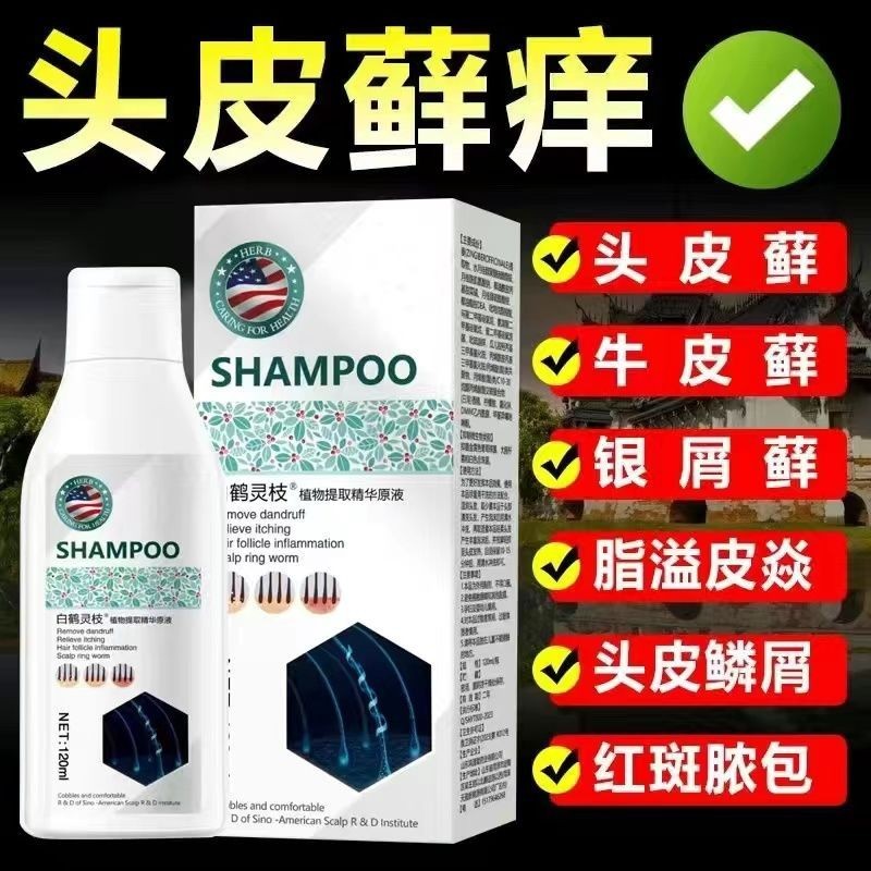 Special Shampoo For Dandruff Scalp Ringworm Scalp Itching Dandruff