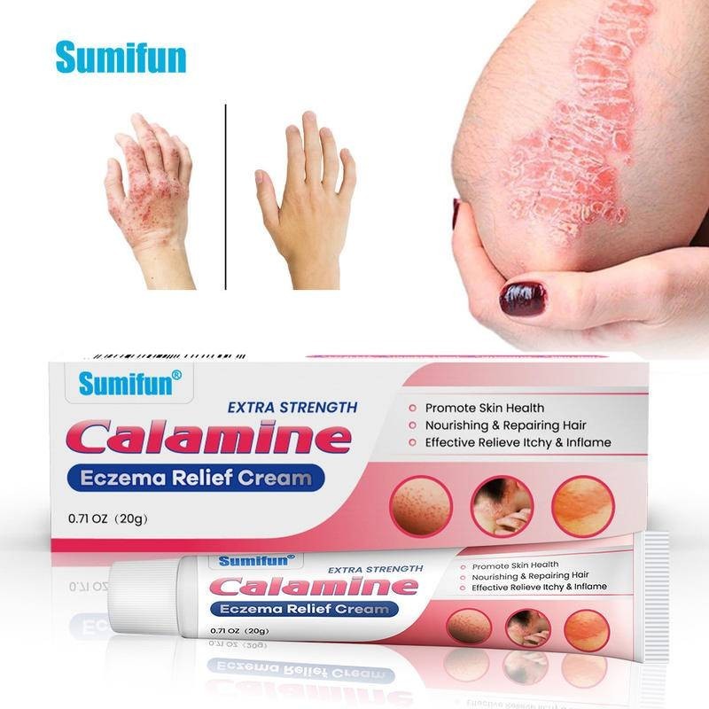 20g Extra Strength Calamine Eczema Relief Cream For Foot/Hand/Body All