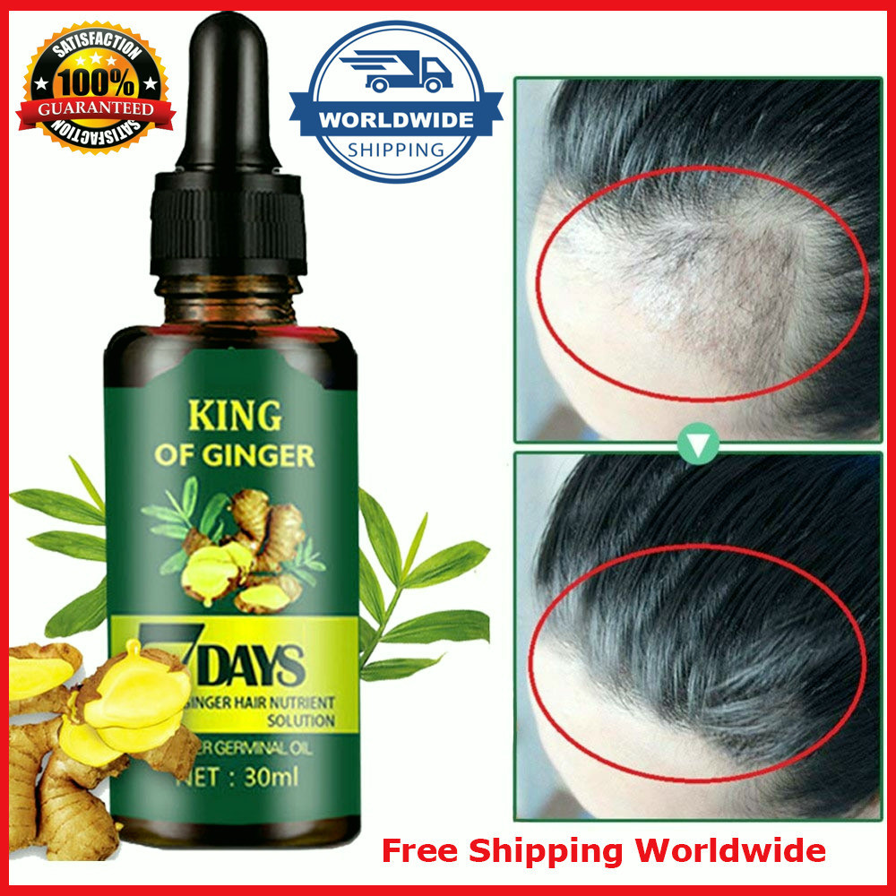 7 Day Ginger Hair Growth Essence Oil Loss Treatement Growth Hair Regrow ...