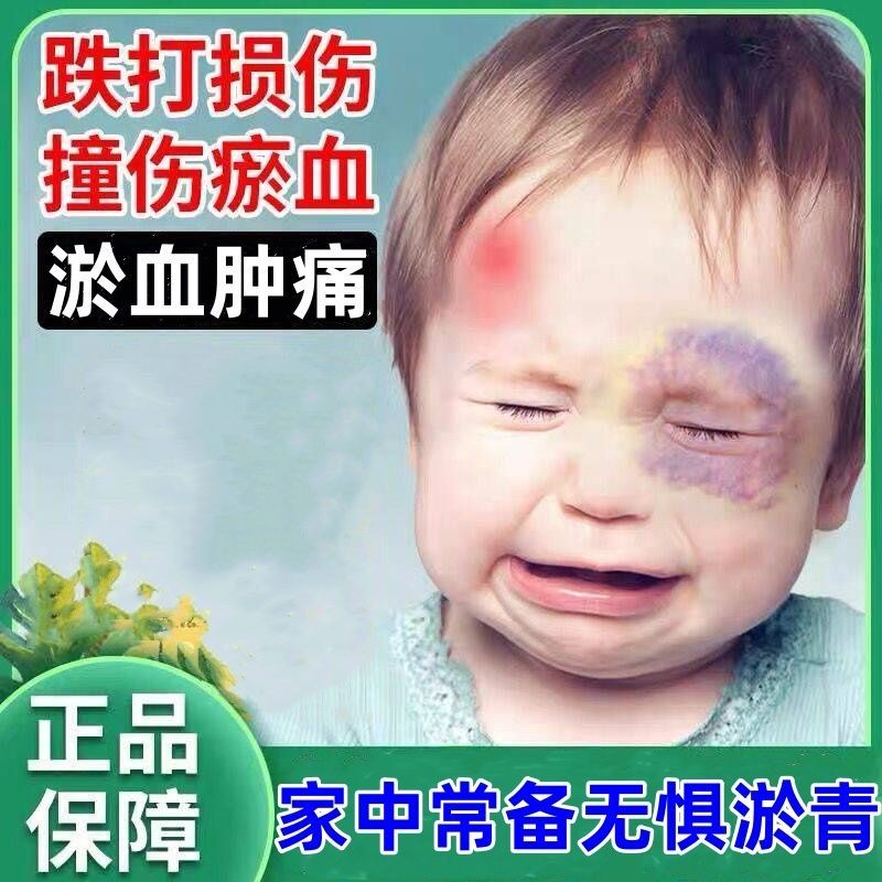 Bruise cream quickly soothes and removes bruising ar Remove bruising