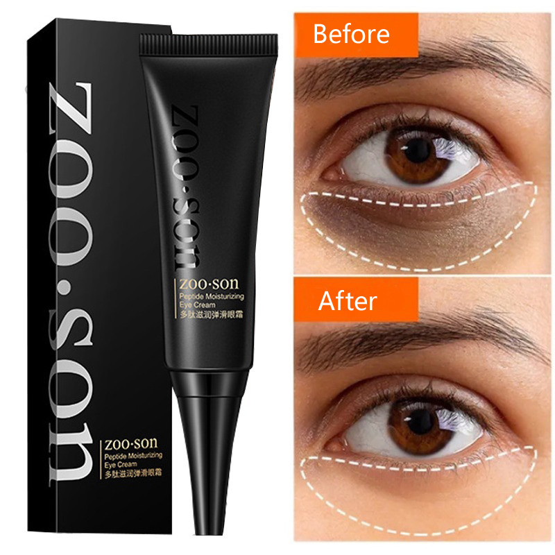 Original Eye Essence Remove Dark Circle Cream Moisturizing Hyaluronic