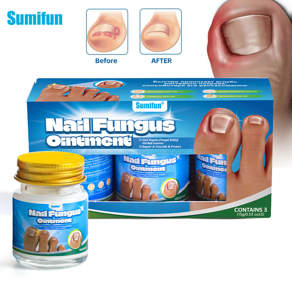 2025 New Style Cream Medicine Gram Three Cans Nail Groove Health Care ...