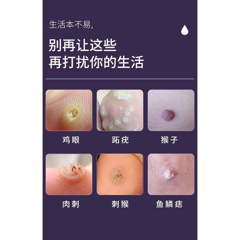 [The Neck Is Flesh Bump Smaller]Keyou Liquid Antimicrobial Neck Skin ...