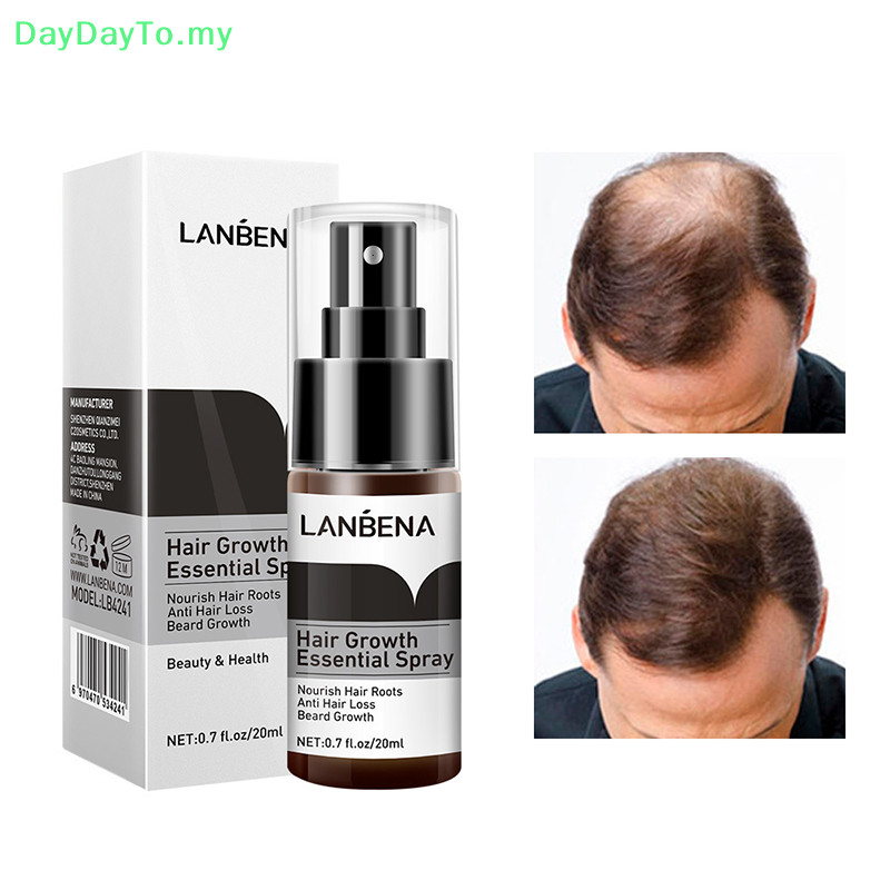DayDayTO Hair Growth Fast Powerful Prevent Baldness AntiHair Loss
