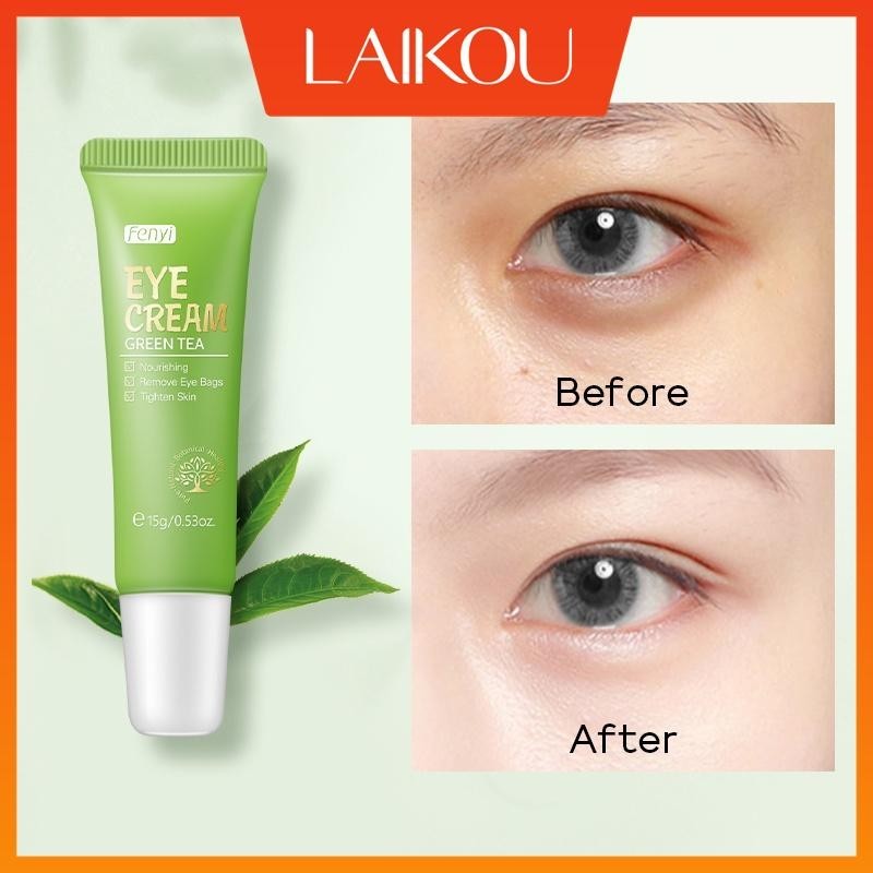 Fenyi Green Tea Eye Cream Remove Bags Wrinkles Dark Circles AntiAging Firming Essence 15g