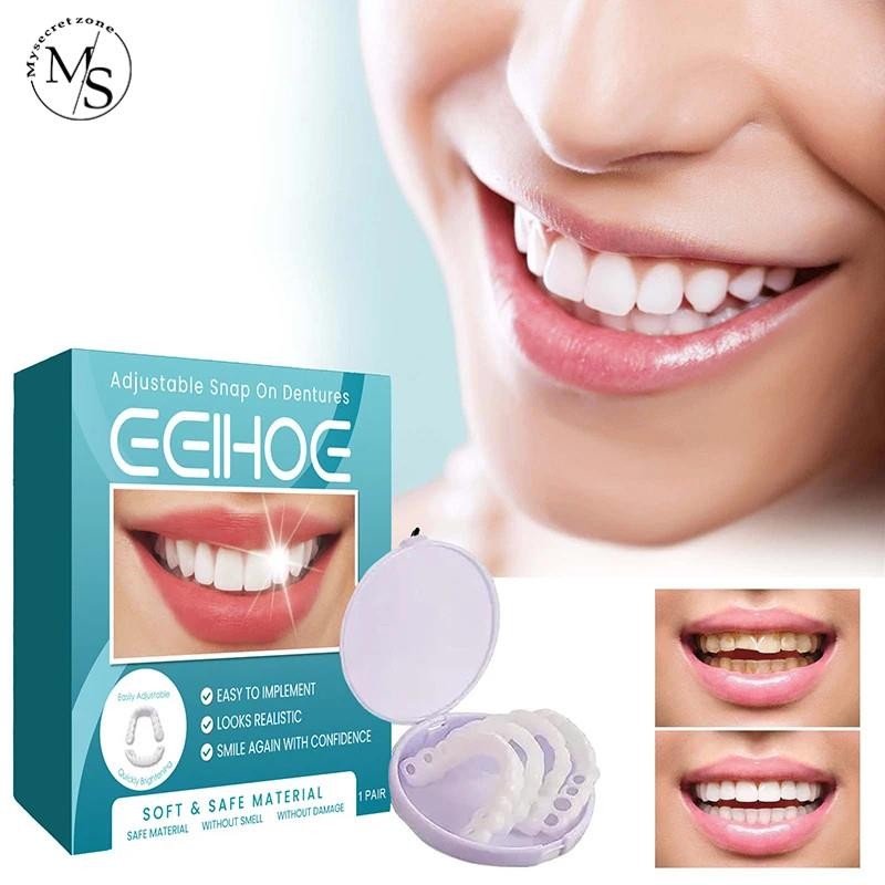 Silicone Deeth Adjustable Denture Teeth Set Adjustable Snap On Portable ...